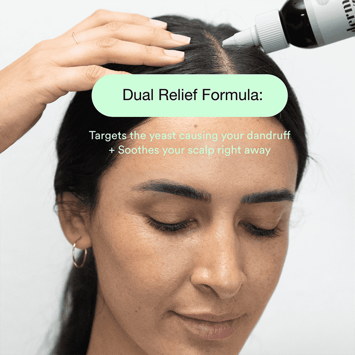 Topical Dermazen Calming Seborrheic Serum bottle with dropper, designed for dandruff and scalp soothing.