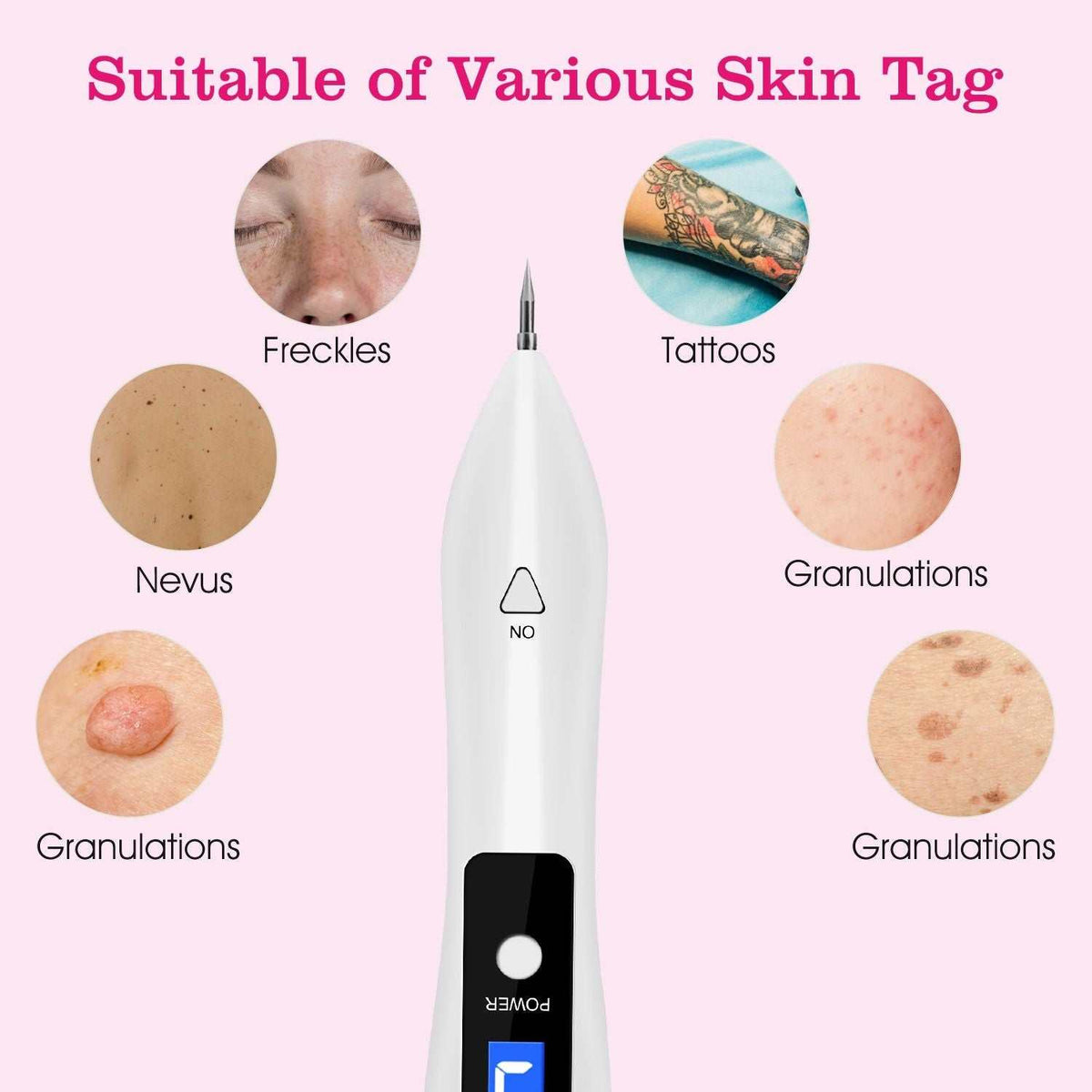 Doba skin tag repair kit with LCD display, USB charging, adjustable levels, and six replaceable needles for home beauty treatments.