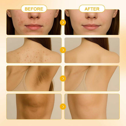 Before and after skin results showing clear, smooth face, back, underarm, and patch improvements using Turmeric Soap & Turmeric Face Wash Set.