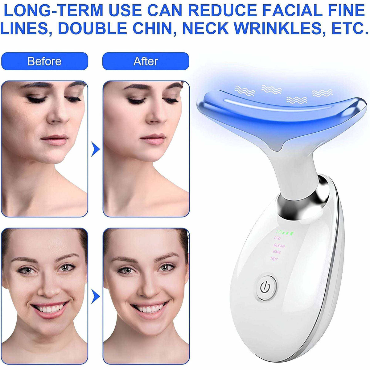 Doba VYSN GlowTone electronic neck and face massager with vibration nodes for lifting and wrinkle reduction, shown in use.