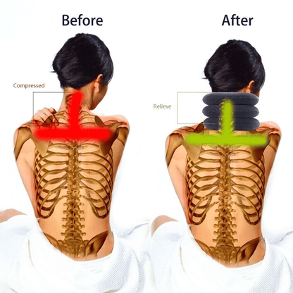 Doba cervical neck traction device collar brace for neck pain relief, featuring adjustable support and therapy stretcher design.